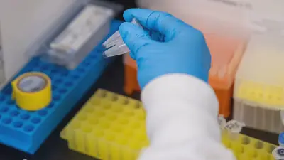 University of Calgary develops new immunotherapy for solid tumours