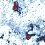 Cyclospora parasite could reach Canada if U.S. can't find cause: expert