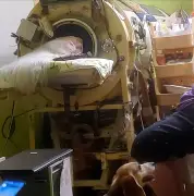 Martha Lillard, last US polio patient in iron lung, dies at 78