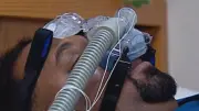 Sleep Apnea Explained: Symptoms and Treatments from Ottawa Expert