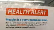 Toronto Public Health Warns of Measles Exposure at Scarborough Locations