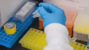 University of Calgary develops new immunotherapy for solid tumours